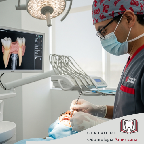 Implantes Dentales de Carga Inmediata